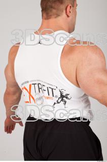 Singlet texture of Gene 0006